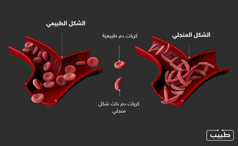 شكل كريات الدم في الأوعية