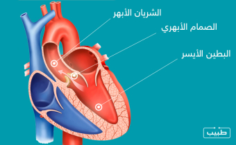 موقع الصمام الأبهري