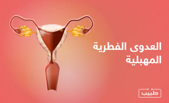 العدوى الفطرية المهبلية