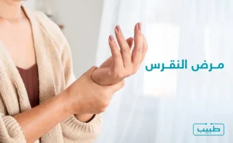 مرض النقرس، وهو نوع من التهاب المفاصل