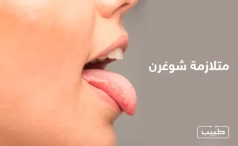 متلازمة شوغرن هي من أمرض المناعة الذاتية