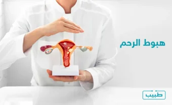 هبوط الرحم هو حالة طبية غير خطيرة لكنها تستوجب العلاج بسبب الأعراض المزعجة المرافقة