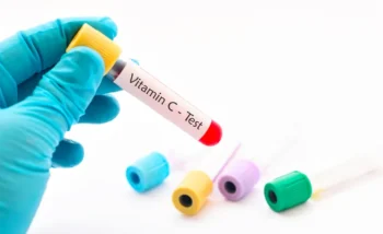 يطلب اختبار فيتامين سي في حالة الشك بوجود نقص بهذا الفيتامين في الجسم