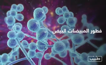 هنالك مجموعة من الأعراض التي تظهر في الأنواع الأربع الأكثر شيوعاً لعدوى المبيضات البيض.