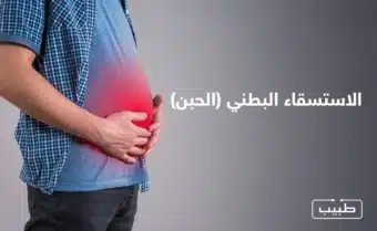 الحبن "Ascites" عبارة عن حالة مرضية تتصف بتراكم كميات زائدة من السوائل في التجويف البطني