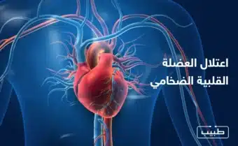 اعتلال العضلة القلبية الضخامي حالة قابلة للعلاج عند تشخيصها